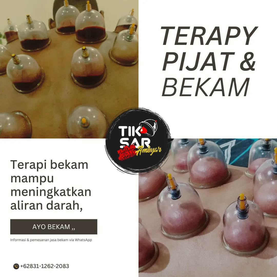 Bekam Sunnah