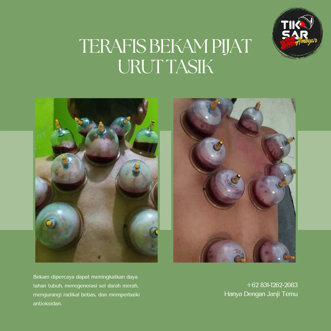 TERAFIS BEKAM PIJAT URUT TASIK